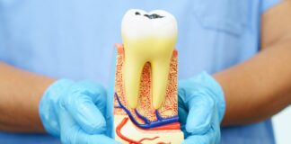 Odbudowa zęba po endodoncji
